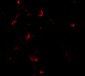 Bim EL Antibody